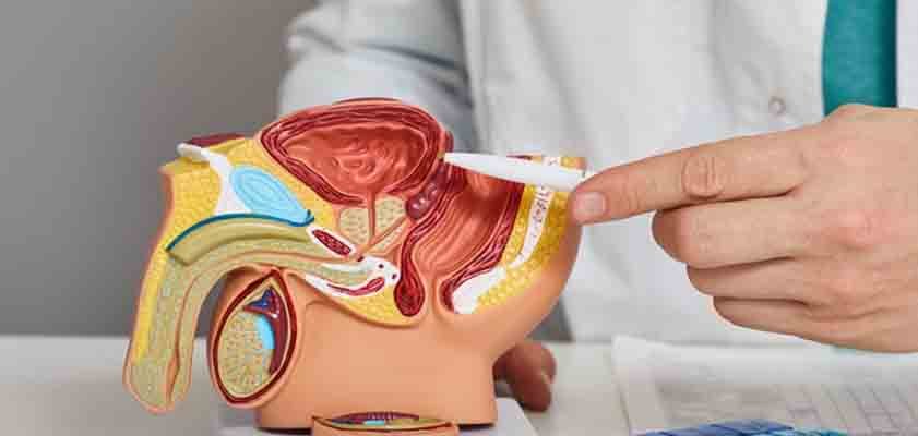 LA SALUD DE LA PROSTATA